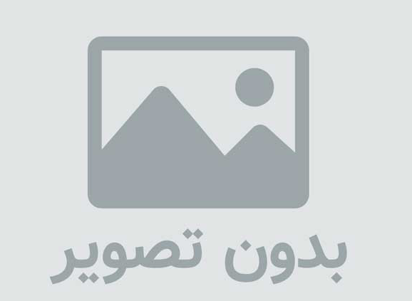 ایمپلنت دندان چیست؟ راهنمای کامل کاشت دندان، مراحل، مزایا و هزینه